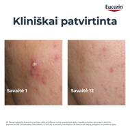 EUCERIN DERMOPURE TRIPLE EFFECT, serumas aknės paliktų dėmių mažinimui (66862) paveikslėlis