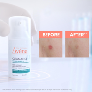 AVENE CLEANANCE COMEDOMED, koncentruota priemonė aknės ir odos nelygumų pažeistai odai prižiūrėti, 30ml paveikslėlis