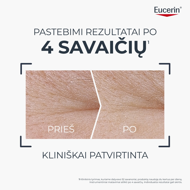 EUCERIN HYALURON-FILLER + LONGEVITY EPIGENETIC, dieninis veido kremas, SPF 30, su Epicelline ir hialurono rūgštimi, 50 ml paveikslėlis EUCERIN HYALURON-FILLER + LONGEVITY EPIGENETIC, dieninis veido kremas, SPF 30, su Epicelline ir hialurono rūgštimi, 50 ml paveikslėlis